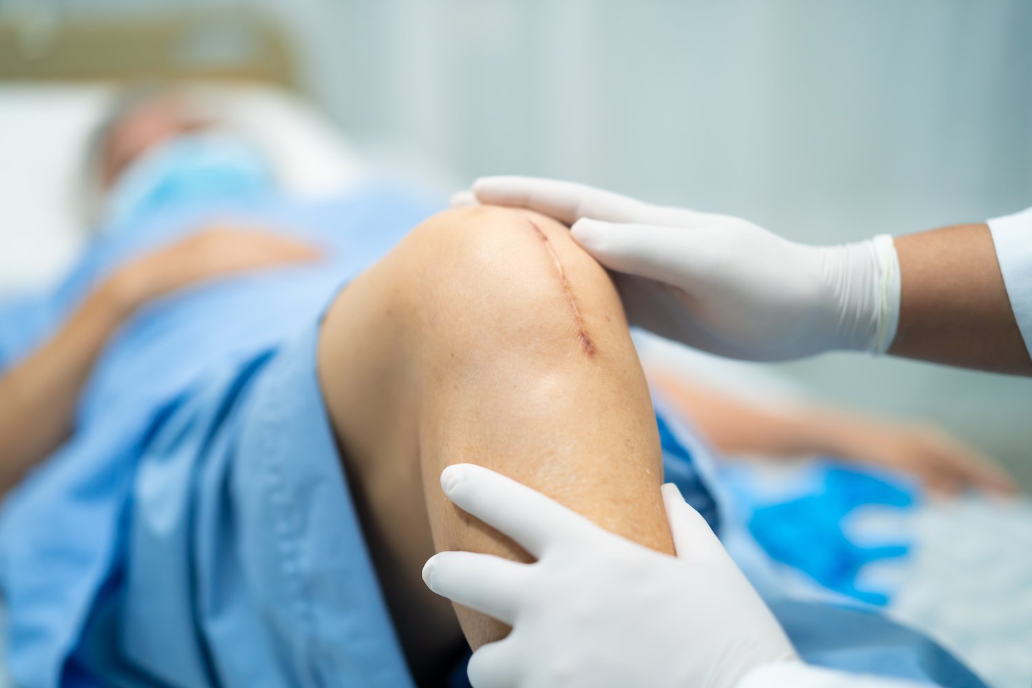Suture discount medical term