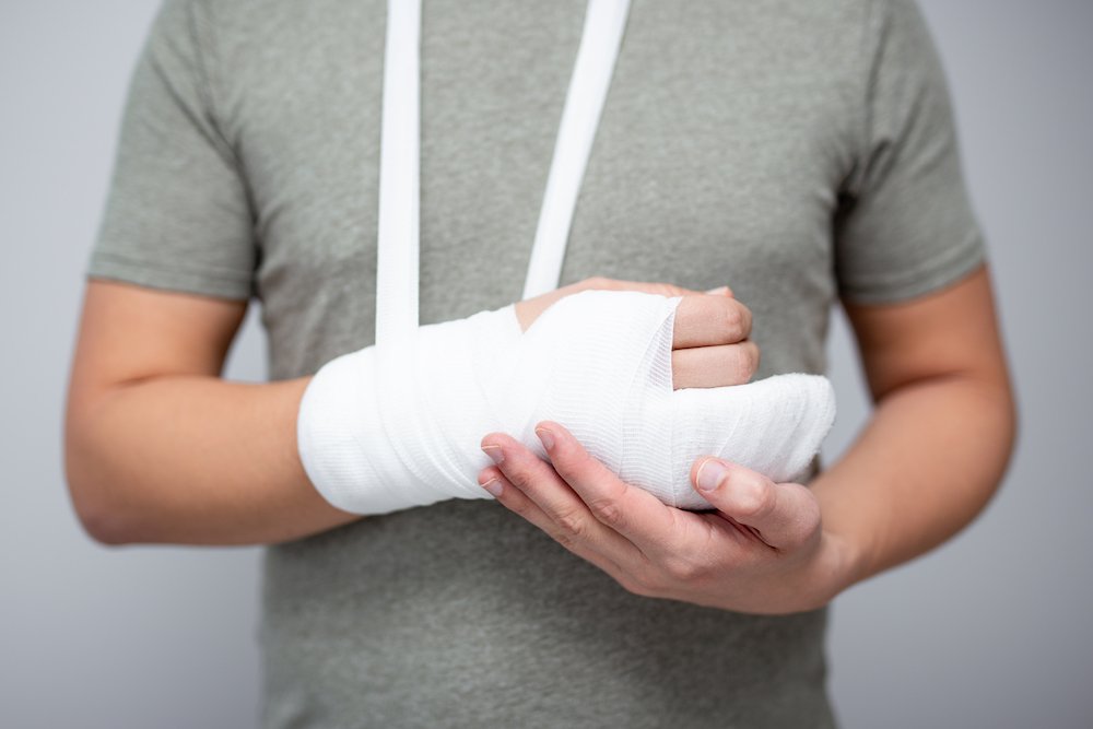 Broken Hand Symptoms, Causes, Diagnosis, and Treatment